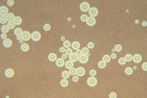 描述: Cryptococcus neoformans